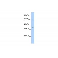 Antibody used in WB on Mouse SP2/0 at 5.0 ug/ml.