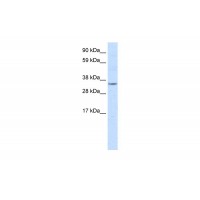 Antibody used in WB on Mouse NIH-3T3 at 2.5 ug/ml.