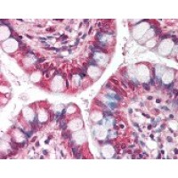 Immunohistochemistry staining of NRM in small intestine tissue using NRM Antibody.