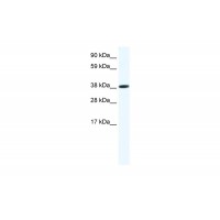 Antibody used in WB on Mouse SP2/0 at 1.25 ug/ml.