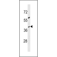 Western blot analysis in MDA-MB453 cell line lysates (35ug/lane).