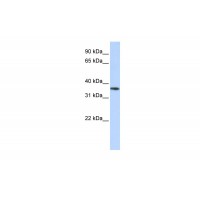 Antibody used in WB on Human Liver cell lysates at 0.2-1 ug/ml.