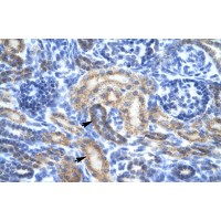 Antibody used in IHC on Human kidney at 4.0-8.0 ug/ml.