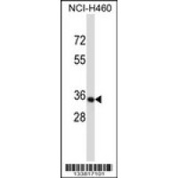 Western blot analysis in NCI-H460 cell line lysates (35ug/lane).