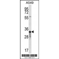 Western blot analysis in A549 cell line lysates (35ug/lane).