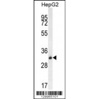 Western blot analysis in HepG2 cell line lysates (35ug/lane).