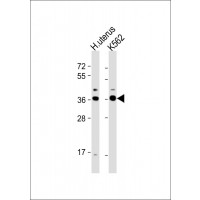 Western Blot at 1:1000 dilution Lane 1: human uterus lysate Lane 2: K562 whole cell lysate Lysates/proteins at 20 ug per lane.