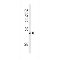 Western blot analysis in 293 cell line lysates (35ug/lane).