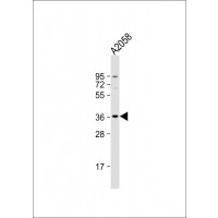 Western Blot at 1:1000 dilution + A2058 whole cell lysate Lysates/proteins at 20 ug per lane.