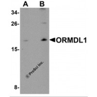 Western blot analysis of ORMDL1 in SK-N-SH Cell lysate with ORMDL1 antibody at (A) 1 μg/mL and (B) 2 μg/mL.