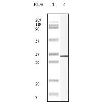 Western blot analysis using P11 monoclonal antibody against truncated P11 recombinant protein