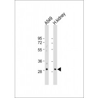 Western Blot at 1:500-1:1000 dilution Lane 1: A549 whole cell lysate Lane 2: human kidney lysate Lysates/proteins at 20 ug per lane.