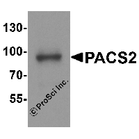 Western blot analysis of PACS2 in mouse brain tissue lysate with PACS2 antibody at 1 μg/ml.