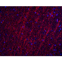 Immunofluorescence of PACS2 in mouse brain tissue with PACS2 antibody at 20 μg/ml.