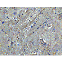 Immunohistochemistry of PACS2 in mouse brain tissue with PACS2 antibody at 5 μg/mL.