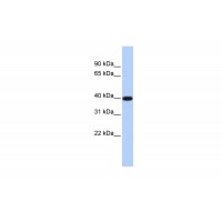 Antibody used in WB on Human Jurkat 0.2-1 ug/ml.