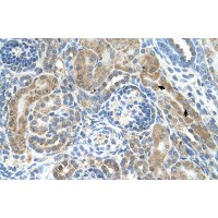 Antibody used in IHC on Human kidney.