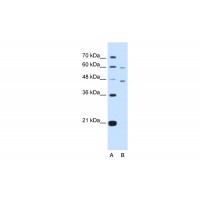 Antibody used in WB on Human HepG2 at 5.0 ug/ml.