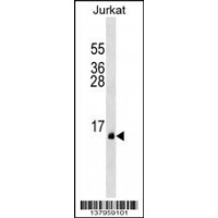 Western blot analysis in Jurkat cell line lysates (35ug/lane).