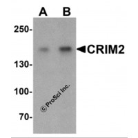 Western blot analysis of CRIM2 in Jurkat cell lysate with CRIM2 antibody at (A) 1 and (B) 2 μg/mL.