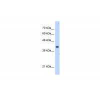 Antibody used in WB on Human HepG2 at 5.0 ug/ml.