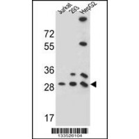 Western blot analysis in 293,HepG2,Jurkat cell line lysates (35ug/lane).