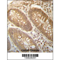 PGAM4 Antibody immunohistochemistry analysis in formalin fixed and paraffin embedded human colon tissue followed by peroxidase conjugation of the secondary antibody and DAB staining.