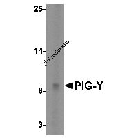 Western blot analysis of PIG-Y in human skeletal muscle tissue lysate with PIG-Y antibody at 5 μg/mL.