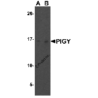 Western blot analysis of PIG-Y in human liver tissue lysate with PIG-Y antibody at (A) 1 and (B) 2 μg/mL.