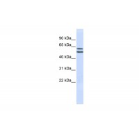 Antibody used in WB on Human Jurkat 0.2-1 ug/ml.