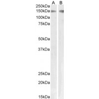 Western Blot (1-3μg/ml) staining of Human kidney (A) and Pig lung (B) lysates.