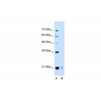 Antibody used in WB on Human HepG2 at 0.2-1 ug/ml.