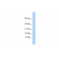 Antibody used in WB on Human Heart at 0.2-1 ug/ml.