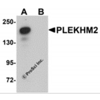 Western blot analysis of PLEKHM2 in rat brain tissue lysate with PLEKHM2 antibody at 0.5 μg/mL in (A) the absence and (B) the presence of blocking peptide.