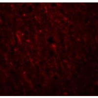 Immunofluorescence of PLEKHM2 in Human Brain cells with PLEKHM2 antibody at 20 μg/mL.