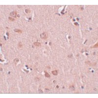 Immunohistochemistry of PLEKHM2 in human liver tissue with FAM59A antibody at 5 μg/mL.