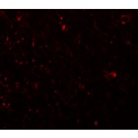 Immunofluorescence of PLKHM3 in human brain tissue with PLKHM3 antibody at 20 μg/mL.