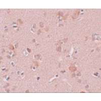 Immunohistochemistry of PLEKHM3 in human brain tissue with PLEKHM3 antibody at 5 μg/mL.
