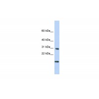 Antibody used in WB on Human Brain at 0.2-1 ug/ml.