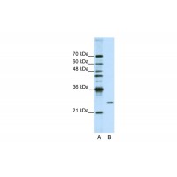 Antibody used in WB on Human HepG2 at 1.25 ug/ml.