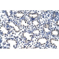 Antibody used in IHC on Human Lung at 4.0-8.0 ug/ml.