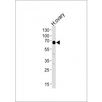 Western blot analysis of lysate from human ovary tissue lysate, using POTEB Antibody at 1:1000 at each lane.