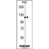 Western blot analysis in K562 cell line lysates (35ug/lane).