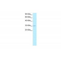 Antibody used in WB on Human HepG2 at 0.2-1 ug/ml.