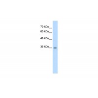 Antibody used in WB on Human HepG2 at 2.5 ug/ml.