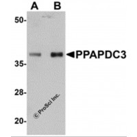 Western blot analysis of PPAPDC3 in mouse heart tissue lysate with PPAPDC3 antibody at (A) 1 and (B) 2 μg/mL.