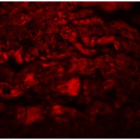 Immunofluorescence of PPAPDC3 in mouse heart tissue with PPAPDC3 antibody at 20 μg/mL.