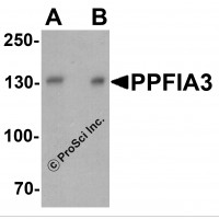 Western blot analysis of PPFIA3 in 293 cell lysate with PPFIA3 antibody at (A) 1 and (B) 2 μg/ml.