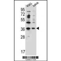 Western blot analysis in K562,Jurkat cell line lysates (35ug/lane).