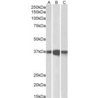 Western Blot (0.1μg/ml) staining of Mouse (A), Rat (B) and Pig (C) Brain lysates (35μg protein in RIPA buffer). Primary incubation was 1 hour. Detected by chemiluminescence.